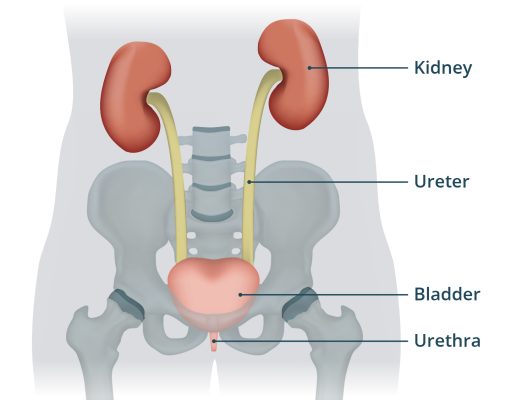 urinary tract infections (UTIs)